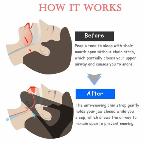 Anti Snore Belt Stop Snoring Chin Strap Woman Man Night Sleeping Aid Tools Snoring Protection Jaw Snore Stopper Bandage One Size